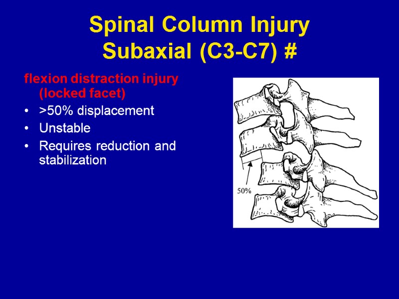 Spinal Column Injury Subaxial (C3-C7) # flexion distraction injury (locked facet) >50% displacement Unstable